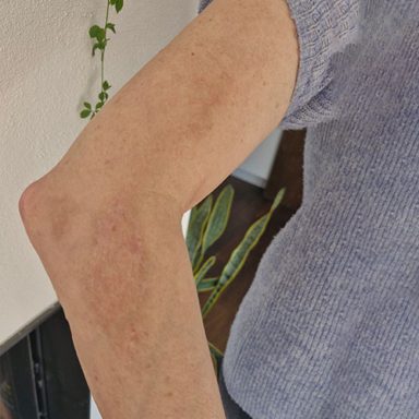 liv_arm_verletzung scenar